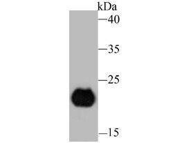PERP Rabbit anti-Human, Mouse, Clone: JU04-51, Novus Biologicals 100 &mu;l;